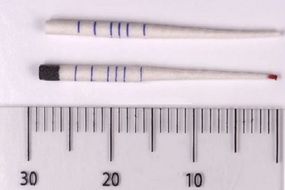 تکنیک کاغذ خشک طول کانال دندان
